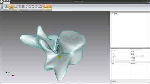 Surface Reconstruction from Point Cloud Data