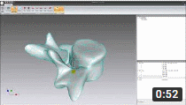 Surface reconstruction from point cloud data